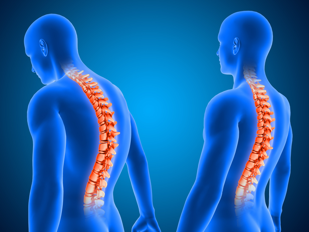 Role Of Physiotherapy In Spinal Cord Injury